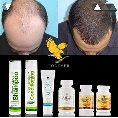 ANTI-CHUTE & BOOST DE CHEVEUX